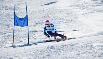 壹号娱乐app：瓜迪奥拉赛后摸头笑叹上帝啊，我头发都掉光了！曼城险胜夜，足球的享受与折磨仅一线之隔